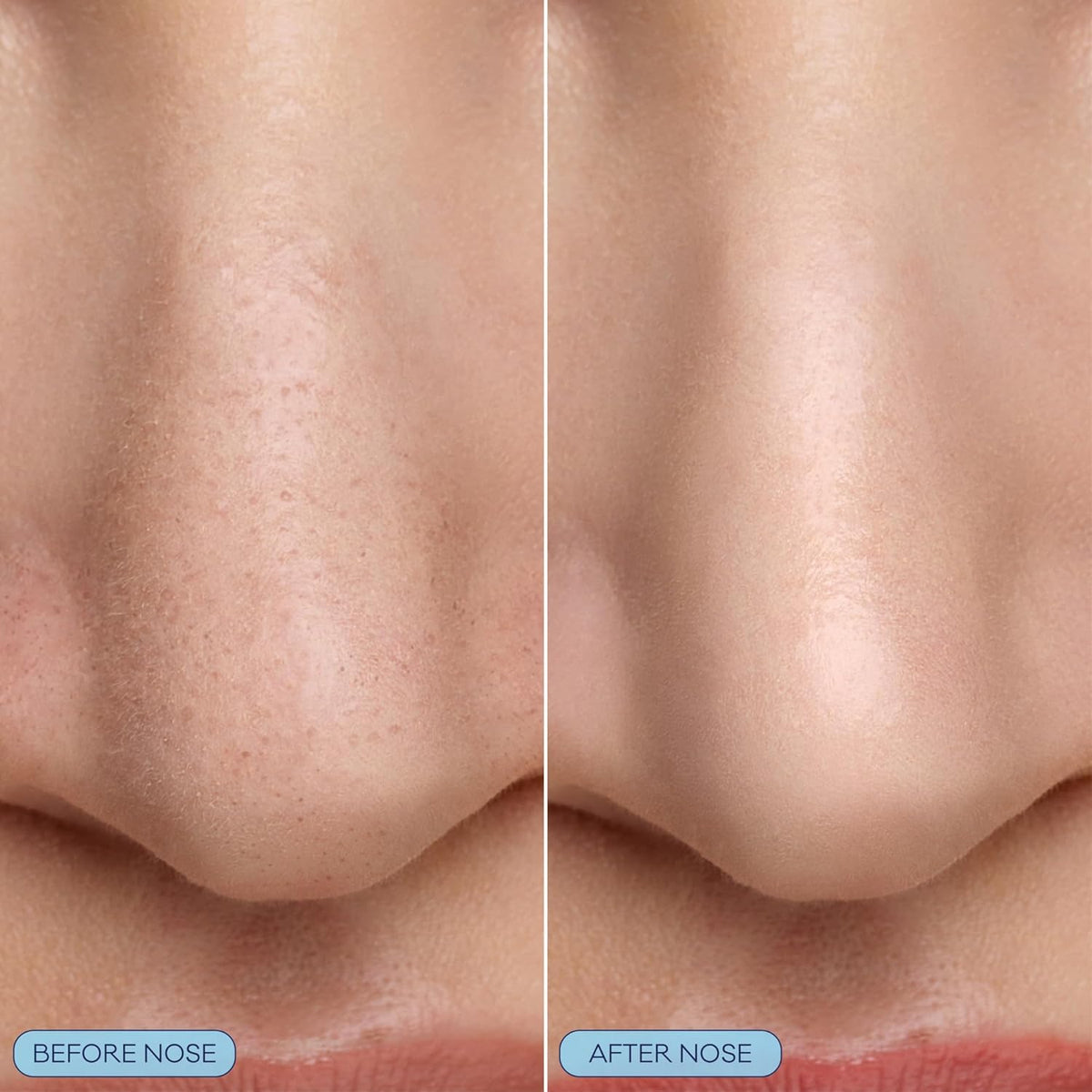 Biore Pore Refining Bubbling Nose Mask, Glycolic Acid Exfoliant, 8 Ct